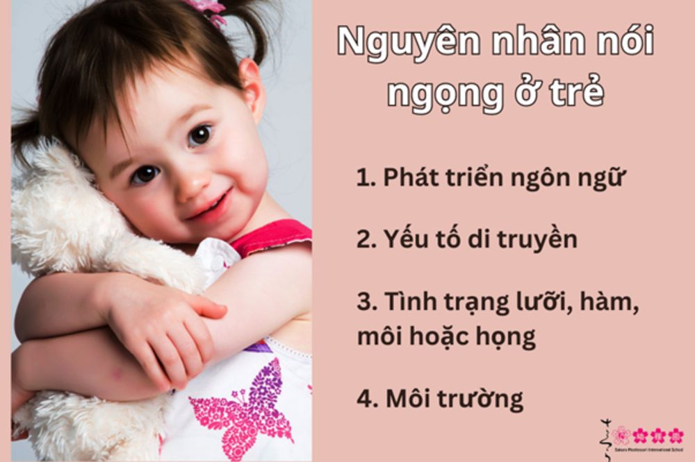 4 nguyên nhân dẫn đến việc trẻ bị nói ngọng