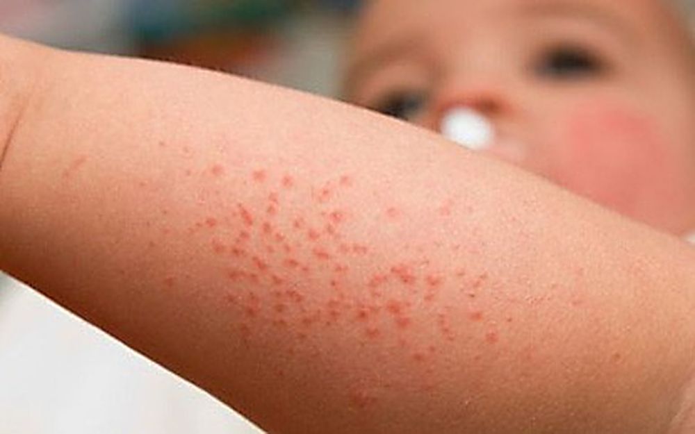 Chuẩn bị sẵn một cuốn sổ tay để ghi lại các triệu chứng của bé sẽ giúp bác sĩ mong đợi bệnh nhanh và chính xác hơn (Ảnh: sưu tầm internet).