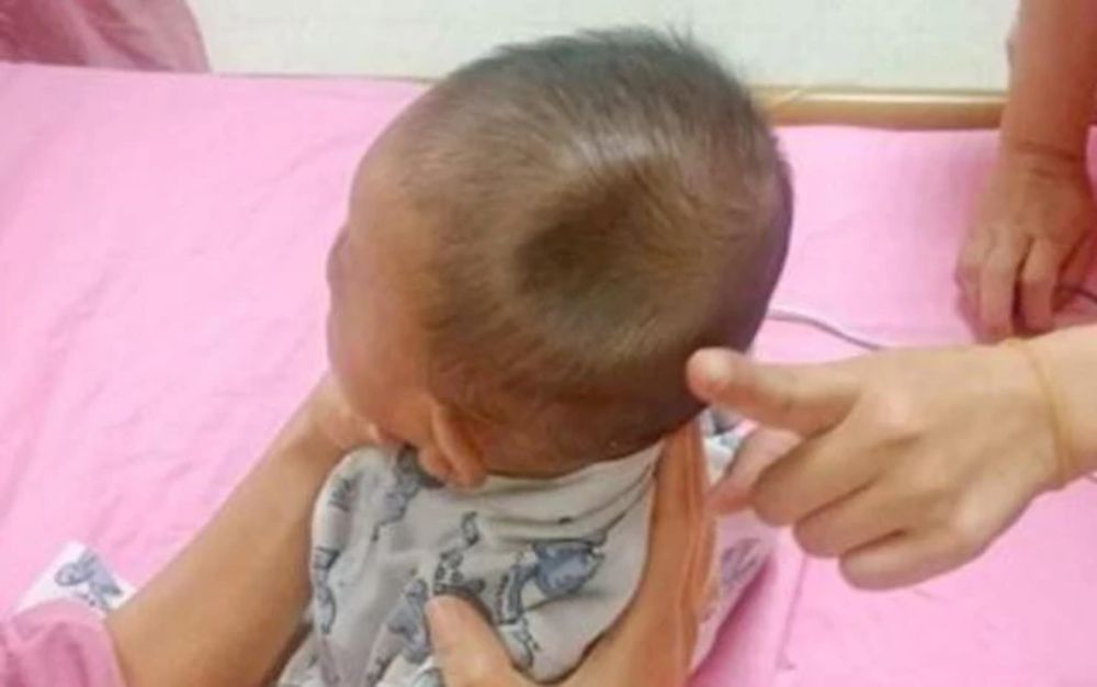 tre-7-thang-bi-nga-tu-tren-giuong-