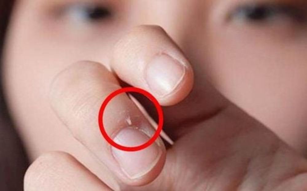 Phân biệt măng rô thông thường và măng rô bị nhiễm trùng (chín mé) để xử lý kịp thời (Ảnh: sưu tầm internet).