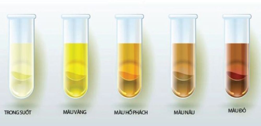 Quan sát màu nước tiểu là cách tốt nhất để biết trẻ 7 tháng uống bao nhiêu nước là đủ