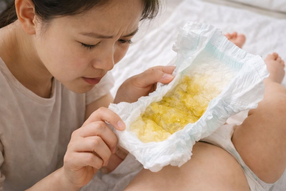 Quan sát số lượng tã ướt và màu sắc nước tiểu là thước đo chính xác nhất.