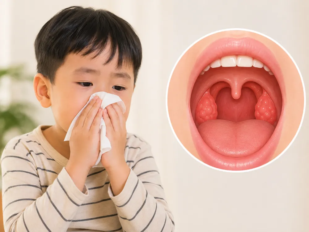 Nghẹt mũi, viêm đường hô hấp trên hoặc VA, amidan phì đại có thể làm cản trở đường thở và khiến trẻ dễ ngủ ngáy.